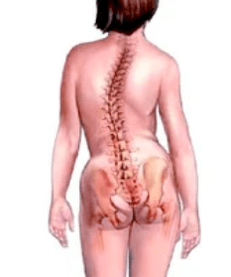 Pathologie du système musculo-skélétique