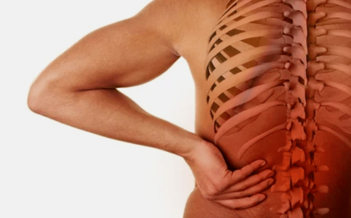 Les causes de l'ostéochondrose lombaire