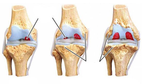 Articulation de grade