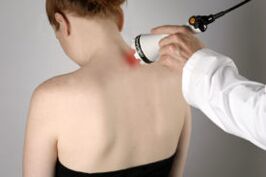 Traitement de l'ostéochondrose cervicale avec thérapie laser