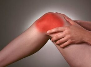 Le symptôme de l'arthrose est une douleur intense dans la zone du genou.